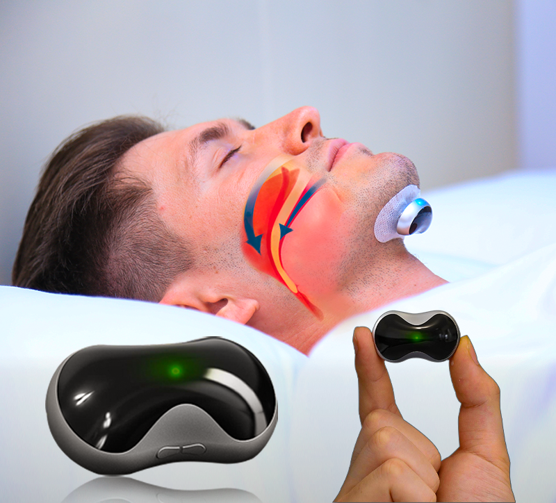 Compact anti-snoring device ensures restful, quiet sleep. A comfortable sleep aid for a peaceful night.