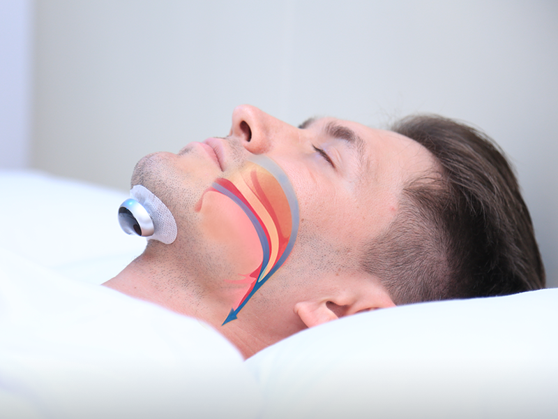 Achieve restful, snore-free sleep with this comfortable anti-snoring device. A premium sleep aid & snore stopper.