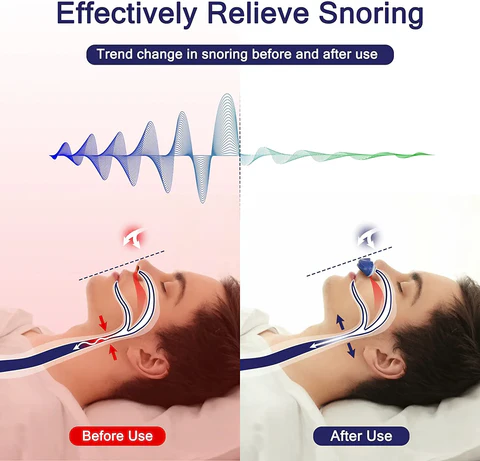 Advanced maskless nasal CPAP device, a compact sleep aid for snoring & sleep apnea. Comfortable design.