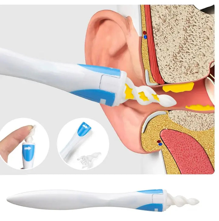 Close-up of a baby-safe spiral earwax remover, featuring flexible silicone tips