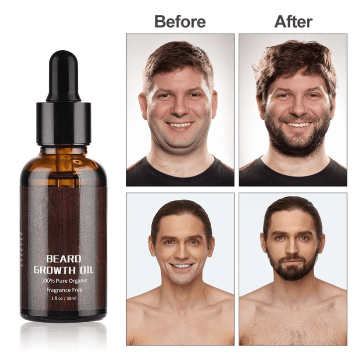 Thicker beard growth promoted by this men's grooming kit. Essential beard oil, balm, & dermaroller for care.
