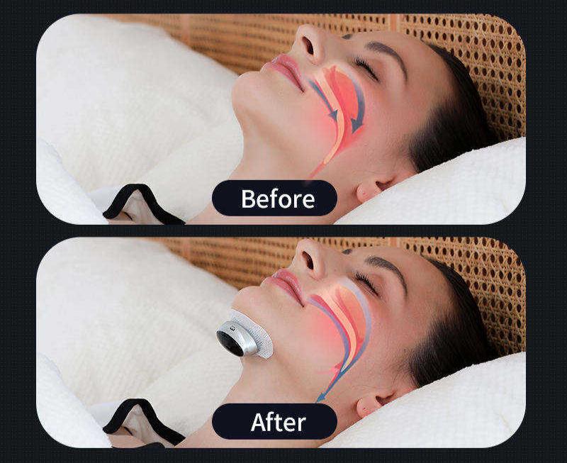 Comfortable, portable AirEase anti-snoring breathing device for sleep apnea & deep sleep.