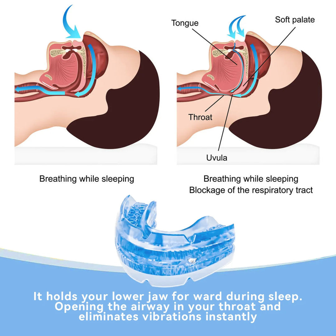 BPA-free anti-snore dental guard, a comfortable sleep aid & mouth guard for effective snoring relief and better sleep.