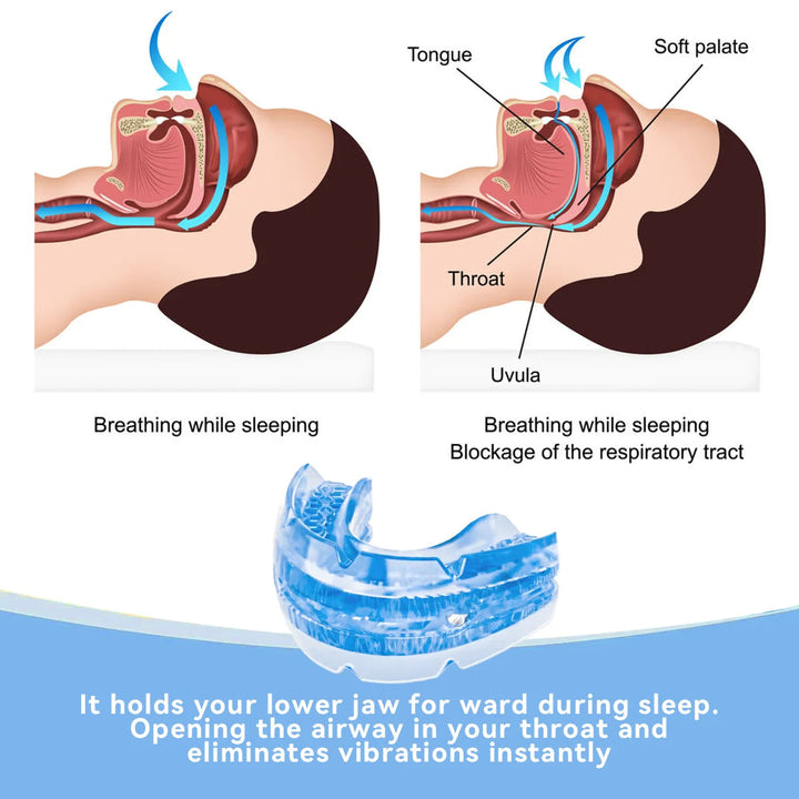 BPA-free anti-snore dental guard, a comfortable sleep aid & mouth guard for effective snoring relief and better sleep.