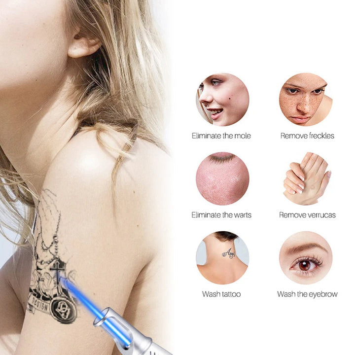 High-tech laser beauty device for safe & effective skin imperfection correction at home.
