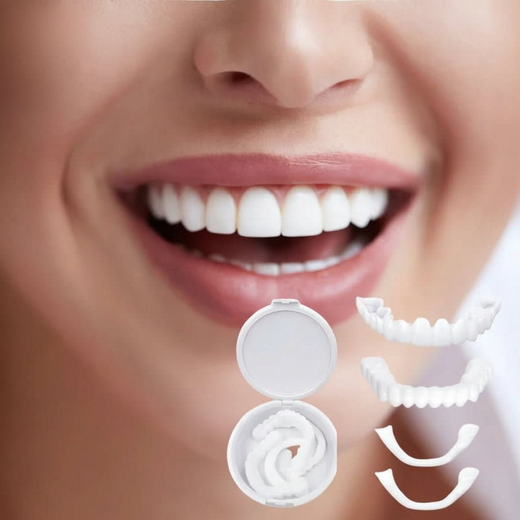 Close-up of instant cosmetic tooth veneers, providing a natural, confident smile for adults.