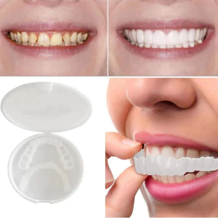 Pair of unisex instant cosmetic tooth veneers showcasing a brighter, confident smile. Easy-to-use dental solution.